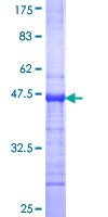 BLIMP1 / PRDM1 Protein - 12.5% SDS-PAGE Stained with Coomassie Blue.