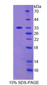 BLK Protein - Recombinant B-Lymphoid Tyrosine Kinase By SDS-PAGE