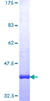 BLM Protein - 12.5% SDS-PAGE Stained with Coomassie Blue.