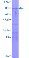 BLMH Protein - 12.5% SDS-PAGE of human BLMH stained with Coomassie Blue