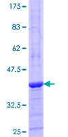 BLMH Protein - 12.5% SDS-PAGE Stained with Coomassie Blue.