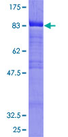 BLNK Protein - 12.5% SDS-PAGE of human BLNK stained with Coomassie Blue