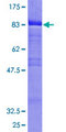 BLNK Protein - 12.5% SDS-PAGE of human BLNK stained with Coomassie Blue