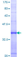 BLNK Protein - 12.5% SDS-PAGE Stained with Coomassie Blue.