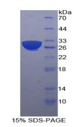 BLNK Protein - Recombinant B-Cell Linker Protein By SDS-PAGE