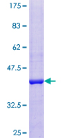 BLOC1S1 Protein - 12.5% SDS-PAGE of human BLOC1S1 stained with Coomassie Blue