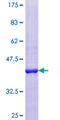 BLOC1S1 Protein - 12.5% SDS-PAGE of human BLOC1S1 stained with Coomassie Blue