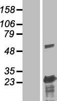 BLOC1S3 Protein - Western validation with an anti-DDK antibody * L: Control HEK293 lysate R: Over-expression lysate
