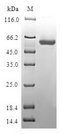 BLVRA Protein - (Tris-Glycine gel) Discontinuous SDS-PAGE (reduced) with 5% enrichment gel and 15% separation gel.