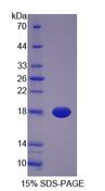 BLVRA Protein - Recombinant  Biliverdin Reductase A By SDS-PAGE