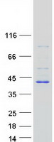 BLVRA Protein - Purified recombinant protein BLVRA was analyzed by SDS-PAGE gel and Coomassie Blue Staining