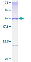 BM022 / MRPL1 Protein - 12.5% SDS-PAGE of human MRPL1 stained with Coomassie Blue