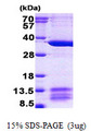 BM022 / MRPL1 Protein