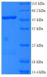 BM022 / MRPL1 Protein