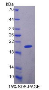BM022 / MRPL1 Protein - Recombinant Mitochondrial Ribosomal Protein L1 By SDS-PAGE