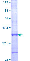 BMAL2 / ARNTL2 Protein - 12.5% SDS-PAGE Stained with Coomassie Blue