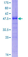 BMF Protein - 12.5% SDS-PAGE of human BMF stained with Coomassie Blue