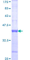 BMP1 Protein - 12.5% SDS-PAGE Stained with Coomassie Blue.