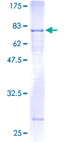 BMP10 Protein - 12.5% SDS-PAGE of human BMP10 stained with Coomassie Blue