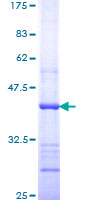 BMP10 Protein - 12.5% SDS-PAGE Stained with Coomassie Blue.