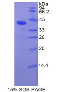 BMP10 Protein - Recombinant Bone Morphogenetic Protein 10 By SDS-PAGE