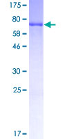 BMP12 / GDF7 Protein - 12.5% SDS-PAGE Stained with Coomassie Blue.