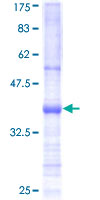 BMP12 / GDF7 Protein - 12.5% SDS-PAGE Stained with Coomassie Blue.