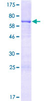 BMP2 Protein - 12.5% SDS-PAGE of human BMP2 stained with Coomassie Blue