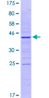 BMP2 Protein - 12.5% SDS-PAGE Stained with Coomassie Blue.