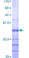 BMP2K / BIKE Protein - 12.5% SDS-PAGE Stained with Coomassie Blue.