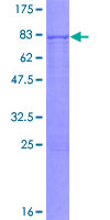 BMP3 Protein - 12.5% SDS-PAGE of human BMP3 stained with Coomassie Blue