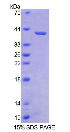 BMP3 Protein - Recombinant  Bone Morphogenetic Protein 3 By SDS-PAGE