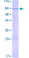 BMP5 Protein - 12.5% SDS-PAGE of human BMP5 stained with Coomassie Blue
