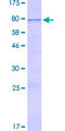 BMP5 Protein - 12.5% SDS-PAGE of human BMP5 stained with Coomassie Blue