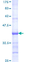 BMP6 Protein - 12.5% SDS-PAGE Stained with Coomassie Blue.