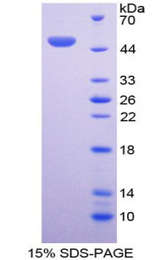 BMP7 Protein - Recombinant Bone Morphogenetic Protein 7 By SDS-PAGE