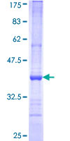 BMP8B Protein - 12.5% SDS-PAGE Stained with Coomassie Blue.