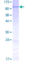 BMPER Protein - 12.5% SDS-PAGE of human BMPER stained with Coomassie Blue