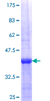 BMPR2 Protein - 12.5% SDS-PAGE Stained with Coomassie Blue.