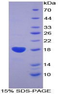 BMPR2 Protein - Recombinant Bone Morphogenetic Protein Receptor 2 By SDS-PAGE