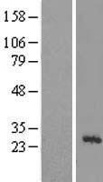 BMRP36a / MRPL43 Protein - Western validation with an anti-DDK antibody * L: Control HEK293 lysate R: Over-expression lysate