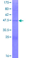 BMRP36a / MRPL43 Protein - 12.5% SDS-PAGE of human MRPL43 stained with Coomassie Blue