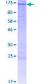 BNC1 / Basonuclin Protein - 12.5% SDS-PAGE of human BNC1 stained with Coomassie Blue