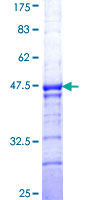 BNC1 / Basonuclin Protein - 12.5% SDS-PAGE Stained with Coomassie Blue.