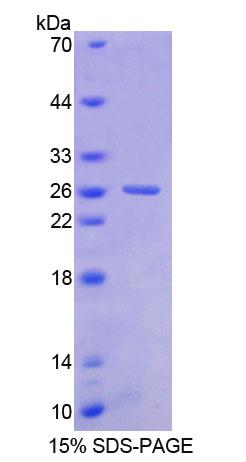 BNC1 / Basonuclin Protein - Recombinant  Basonuclin 1 By SDS-PAGE