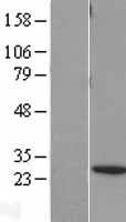 BNIP1 Protein - Western validation with an anti-DDK antibody * L: Control HEK293 lysate R: Over-expression lysate