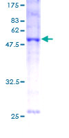 BNIP1 Protein - 12.5% SDS-PAGE of human BNIP1 stained with Coomassie Blue
