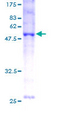BNIP1 Protein - 12.5% SDS-PAGE of human BNIP1 stained with Coomassie Blue