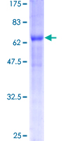 BNIP2 Protein - 12.5% SDS-PAGE of human BNIP2 stained with Coomassie Blue