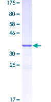 BOB / GPR15 Protein - 12.5% SDS-PAGE Stained with Coomassie Blue.
